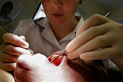 Российский стоматолог развенчала мифы о кариесе
